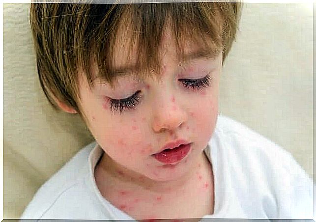 7 infectious diseases of school-age children