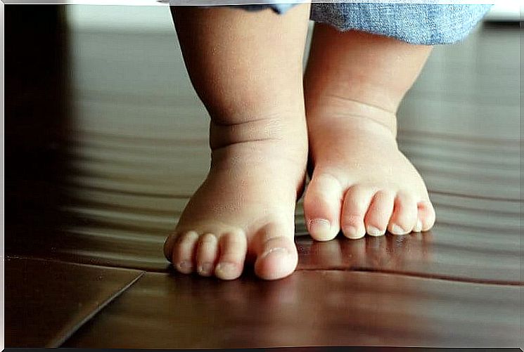 Why does a child have leg legs?