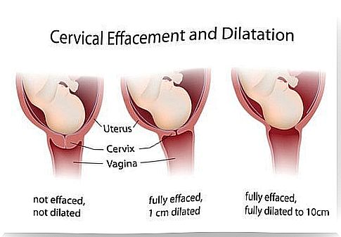 Stages of labor: Opening stage