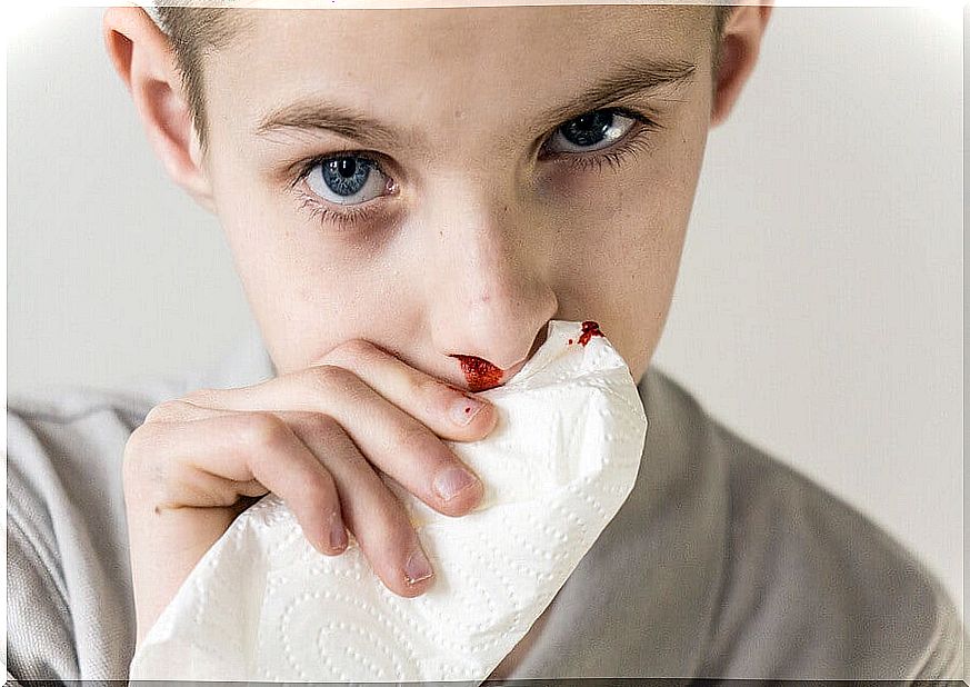 What causes a child's nosebleed and how is it treated?