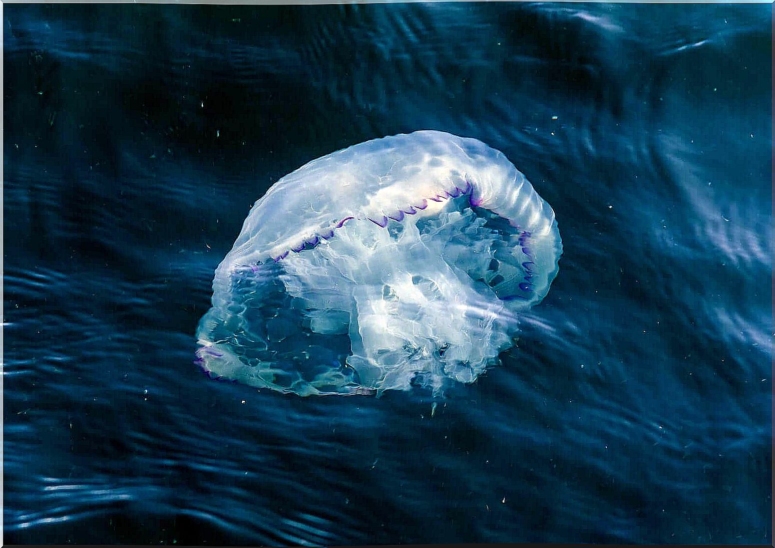 What to do if a jellyfish stings a child?